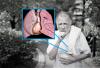 Un caillot de sang dans l'artère pulmonaire: ne manquez pas les premiers signes
