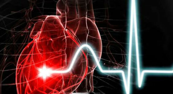 Infarctus - crise cardiaque