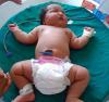 6 à 8 kg: les plus gros nouveau-nés du monde
