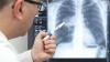 Un médecin compare l'exposition aux radiations avec la tomodensitométrie des poumons avec les radiations à Hiroshima