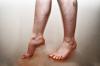 Violation de la circulation sanguine dans les jambes: causes, symptômes