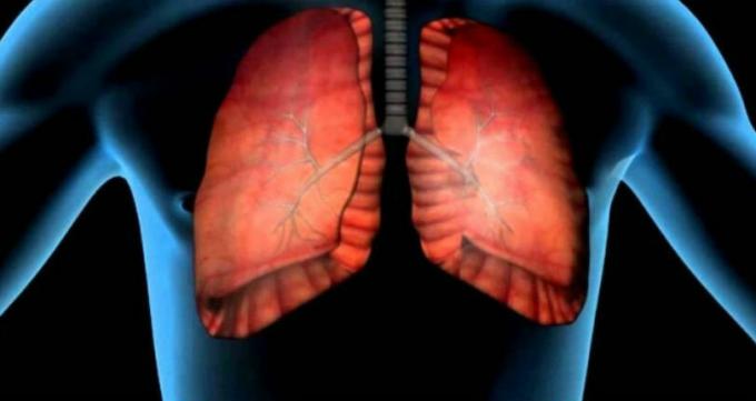 Le cancer du poumon