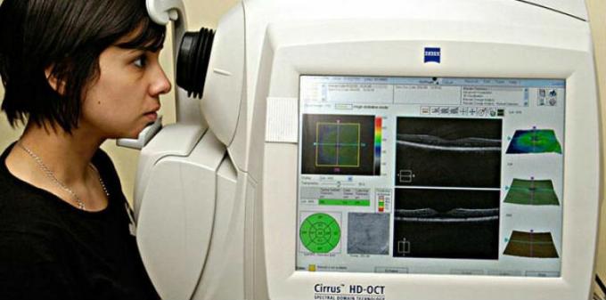 angiographie tomographie par cohérence optique