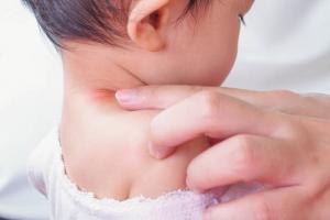 Teigne est un enfant: sources d'infection, les symptômes et le traitement