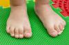 Formes «bonnes» et «mauvaises» de pieds plats chez les enfants