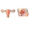 Qu'advient-il de l'utérus avant et après l'accouchement: ce sondage sur les besoins