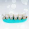 Les dents de attelles populaires: combien il efficace?