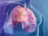 La tumeur dans le poumon: 5 signes