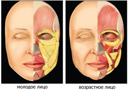 Modification des plis de graisse sur le visage avec l'âge
