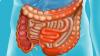 Intestin malade: 5 signes