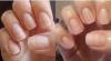 Comment restaurer vos ongles après une accumulation, ainsi que pour renforcer la plaque à ongles