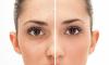4 outils puissants pour se débarrasser des pores sur le visage