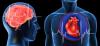 Crise cardiaque et accident vasculaire cérébral: 7 erreurs majeures qu'ils provoquent