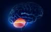 Une tumeur du cervelet: Les symptômes de pathologie
