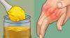 Comment se débarrasser de la douleur dans les articulations des mains